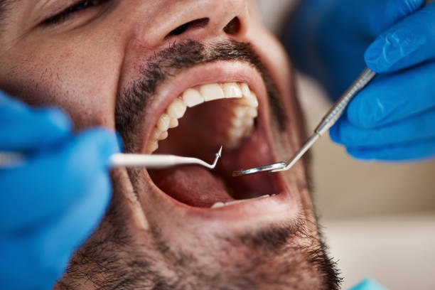 Best Emergency Dental Services for Seniors in Mogul, NV